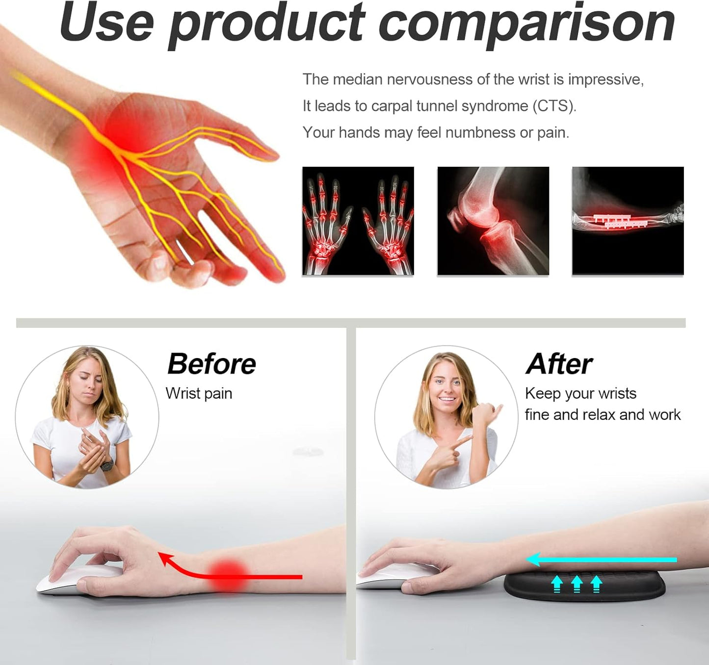 Vaydeer Cloud Elbow Pad, Desk Arm Rest Support, Soft Memory Foam Wrist Rest, Ergonomic Cushion Padding, Carpal Tunnel Pain Relief Gel Mouse Pillow for Computer Laptop Office Gaming Car Chair Accessory